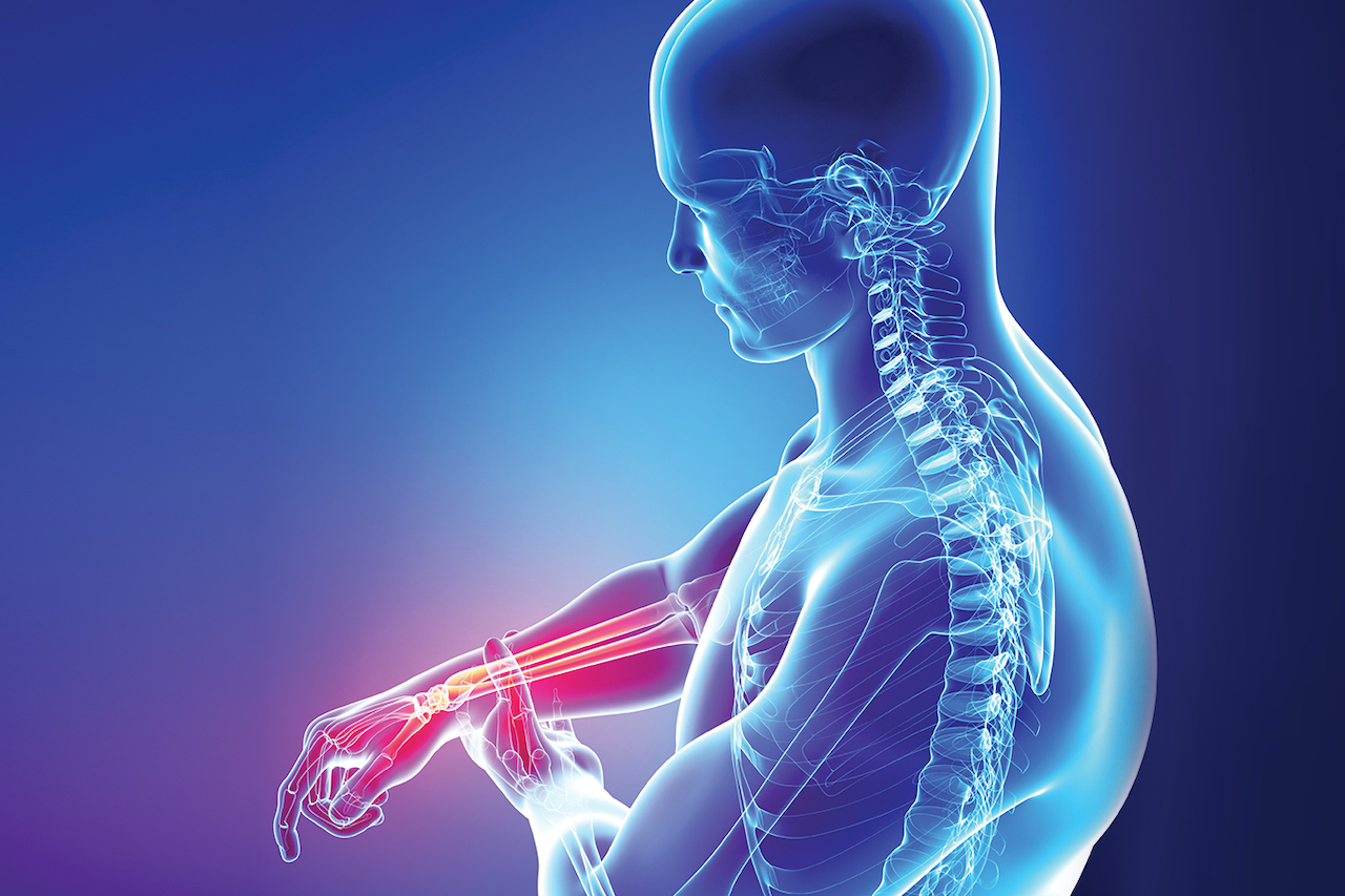 dolori articolari e patologie reumatiche